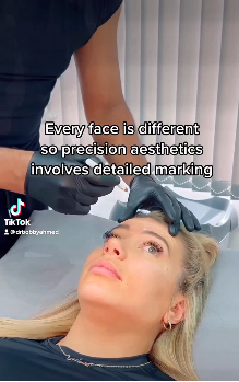 Our style is very subtle. We believe that the skill in facial aesthetics medicine lies in keeping the overall look natural, in keeping with peoples’ age and own aesthetics.

Know more: https://www.regentstreetclinic.co.uk/facial-aesthetics/