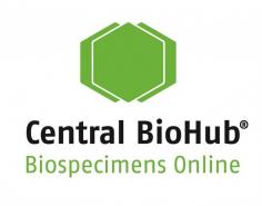 Central BioHub provides access to well-preserved Peripheral Blood Mononuclear Cells (PBMCs) from COVID-19 patients of various ages, genders, and ethnicities for cytological examination of SARS-CoV-2 viral infection. PBMCs, also known as agranulocytes, are critical in regulating human immunity, and they consist of dendritic cells, monocytes, and lymphocytes such as T-cells, B-cells, and NK cells. These samples are readily available for purchase and come with extensive annotations. Hurry up, and explore the inventory today to instantly place orders, quotations, or reservations through the online store or mobile app.