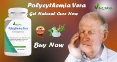 Treating Polycythemia Vera Naturally involves a holistic approach that encompasses lifestyle modifications and herbal remedies etc.
