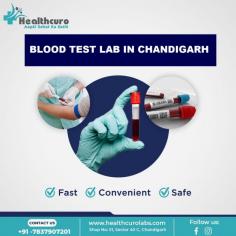 Get accurate and reliable blood test Lab in Chandigarh. Our state-of-the-art facilities provide comprehensive diagnostic solutions. Schedule your blood test today for timely and precise results.
https://healthcurolabs.com/blood-test-labs-in-chandigarh/
