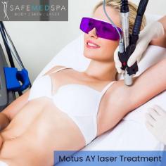 Safe Med Spa in Lansing offers Motus AY Laser Hair Removal, a cutting-edge treatment that provides safe and effective hair removal with precision and comfort, leaving you with silky-smooth skin. Say goodbye to unwanted hair with this advanced technology at Lansing's trusted Safe Med Spa. For more, contact us now. 

