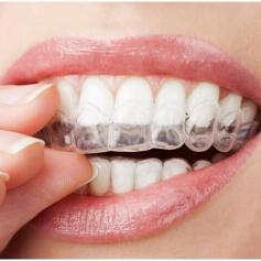 Get the best tooth bleaching and teeth whitening in Santa Ana CA. Get the best treatment on Teeth Whitening Tray in Santa Ana CA.
