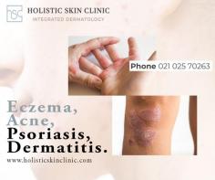 Manage psoriasis effectively with the specialized care at Holistic Skin Clinic in Auckland. Our experienced team provides comprehensive treatment options tailored to your unique needs, focusing on reducing symptoms and improving overall skin health. Trust us to help you lead a more comfortable life with our effective psoriasis treatment in Auckland.
