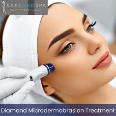 Experience the ultimate skin rejuvenation with our microdermabrasion treatment at Safe Med Spa. This non-invasive procedure exfoliates and revitalizes your skin, leaving you with a fresh, radiant complexion. If you want more information about our website visit now. 