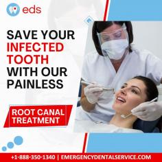 Save Infected Tooth with Painless Root Canal Treatment | Emergency Dental Service 

You can save your infected tooth with our painless root canal treatment. Our team of experts will help you save your infected tooth with our painless root canal treatment, one of the most effective ways to prevent total tooth loss. For more information call us at 1-888-350-1340.