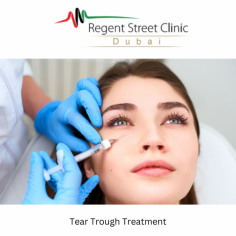 Tear Trough Treatment Dubai

Under eye treatment for dark circles, volume loss or wrinkles has always been a tricky undertaking due to the anatomy of the region (mainly relating to the blood supply and lymphatic drainage in the areas under each eye).

See more: https://www.regentstreetclinicdubai.com/tear-trough-treatment/