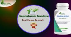 To treat a skin condition, Natural Remedies for Granuloma Annulare can be applied on regular basis to get a positive outcome.