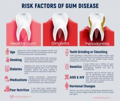 Risk Factors of Gum Disease