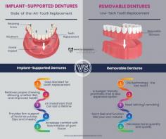 Implant-Supported Dentures