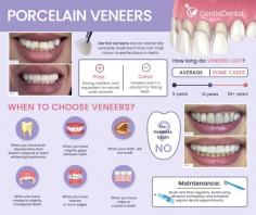 One of the most popular and effective ways to restore damaged, misshapen, or discolored teeth, is with porcelain veneers. These are thin yet highly durable porcelain sheets that are bonded to the front surfaces of teeth. They are created to ensure they ideally complement the size, color, texture, and shape of your natural teeth.

Porcelain veneers have a very natural appearance. Like natural tooth enamel, porcelain is translucent, so they have a subtle radiance that will draw attention to your stunning new smile. In addition to being extremely natural-looking, porcelain veneers can also be used to correct a variety of orthodontic problems. Indeed, veneers are so effective in resolving minor alignment problems that many patients use them as a form of “instant orthodontics.” Resilient, strong, and highly resistant to staining, porcelain veneers can last for many years with proper care.

When you visit Gentle Dental to discuss cosmetic dental treatments like veneers, we will always recommend the solution we feel best suits your needs. For more information about dental veneers, contact Gentle Dental at (718) 461-0100.

Gentle Dental in Queens
35-30 Francis Lewis Blvd,
Bayside, NY 11358
(718) 461-0100
(718) 970-7304
Web Address https://www.queenssmile.com
https://queenssmile.business.site/
E-mail info@queenssmile.com

Our location on the map: https://goo.gl/maps/8gvPR13tEZWAedBw5

Nearby Locations:
Bayside | Auburndale | Broadway - Flushing | Clearview | Bay Terrace
11360, 11361, 11364 | 11358 | 11354 | 11359

Working Hours :
Monday: 9AM-7PM
Tuesday: 9AM-7PM
Wednesday: 9AM-7PM
Thursday: 9AM-7PM
Friday: 9AM-7PM
Saturday: 9AM-4PM
Sunday: Closed

Payment: cash, check, credit cards.
