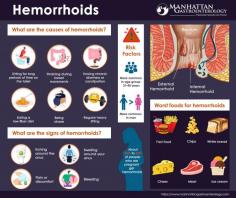 Hemorrhoids are swollen and inflamed veins that can cause discomfort and bleeding in the rectum and anus. If you suspect hemorrhoidal disease, you should always be evaluated with a thorough consultation and examination by a physician for an accurate diagnosis, treatment plan and to exclude a serious illness or condition such as colon or anal cancer. Hemorrhoidal disease is just one of the many causes of rectal bleeding and lesions around the anus that need evaluation. Rectal bleeding can be a symptom of any type of colorectal or anal cancer, which can be cured if detected early.

Piles are extremely common. Piles are a very common occurrence. Approximately half of the population develops symptoms of this health condition by the age of 50 [1]. Internal hemorrhoids form inside your anal canal, whereas external hemorrhoids form under the skin around your anus. If blood pools in an external hemorrhoid, it may form a clot called a thrombus. This condition can result in severe pain and inflammation.

This health condition can be very painful. For the best hemorrhoid treatment options, including laser hemorrhoid treatments, see our NYC hemorrhoids doctors. Emergency appointments are available at the NYC doctor’s office.

As the best-in-class gastroenterologists, our hemorrhoid doctors provide highly personalized and comprehensive care. Their philosophies regarding the doctor/patient relationship are based on trust and have earned them some of the most respected reputations in New York.

For more information about hemorrhoid treatment options or to schedule a consultation with one of our hemorrhoid specialists, please contact our NYC gastroenterology office.

Read more: https://www.manhattangastroenterology.com/hemorrhoids/

Manhattan Gastroenterology
Union Square
55 W. 17th St, Ste 102,
New York, NY 10011
(212) 378-9983

Upper East Side
983 Park Ave, Ste 1D,
New York, NY 10028
(212) 427-8761
Web Address https://www.manhattangastroenterology.com
https://manhattan-gastroenterology.business.site
https://manhattangastroenterology.business.site/
E-mail info@manhattangastroenterology.com 

Our locations on the map:

Union Square https://goo.gl/maps/iyoSymzvWrhou8EG8
Upper East Side https://goo.gl/maps/6m8pgy24rDzCxTxX6

Nearby Locations:
Union Square
Gramercy Park | Rose Hill | Kips Bay | Nomad | Murray Hill | Koreatown
10010 | 10016 | 10453 | 10017

Nearby Locations:
Upper East Side
Yorkville | Manhattan Valley | Lenox Hill | Sutton Place | Carnegie Hill | East Harlem
10028 | 10025 | 10021| 10022 | 10029

Working Hours: (Union Square)
Monday: 8:00 am - 7:00 pm
Tuesday: 8:00 am - 7:00 pm
Wednesday: 8:00 am - 7:00 pm
Thursday: 8:00 am - 7:00 pm
Friday: 8:00 am - 5:00 pm
Saturday:CLOSED
Sunday:CLOSED

Working Hours: (Upper East Side)
Monday: 8:00 am - 6:00 pm
Tuesday: 8:00 am - 6:00 pm
Wednesday: 8:00 am - 6:00 pm
Thursday: 8:00 am - 6:00 pm
Friday: 8:00 am - 6:00 pm
Saturday: CLOSED
Sunday: CLOSED

Payment: cash, check, credit cards.