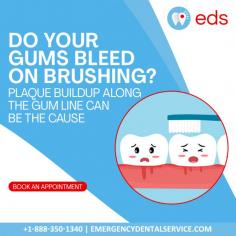 Gums Bleeding? | Emergency Dental Service

Concerned about bleeding gums during brushing? It could be due to plaque buildup along the gum line. Prioritize your oral health and seek guidance from a dentist. Say goodbye to bleeding gums with our expert care. Schedule an appointment at 1-888-350-1340.