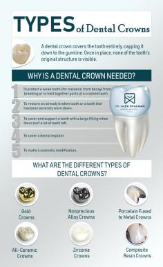 When a tooth is broken or chipped, the resulting pain requires immediate attention. Fortunately, Dr. Alex Shalman in Downtown NYC offers a range of cosmetically perfect teeth crowns that protect damaged teeth while restoring your smile to its full radiance. Ceramic crowns, porcelain crowns, and zirconia dental crowns are all options. Dr. Shalman guides your choice to the most appropriate for your situation and budget. Call today to discover how dental crowns in NYC can help your smile. He has weekend and evening hours, too.

What Is a Dental Crown?
A dental crown is a protective cap that your dentist cements onto a decayed or broken tooth to restore it to its original condition. A color-matched filling may be effective for treating a minor cavity, but it is not sufficient for larger damage to a single tooth. A dental crown, for example, is required after a root canal procedure to cover and protect the tooth from further decay.

Dr. Alex Shalman is a family dentist who is also an excellent cosmetic dentist in Lower Manhattan. He cares about your oral health first and foremost, but he also cares about the appearance of your smile. As a result, he not only provides the best teeth crowns, expertly prepared and placed, but also the most advanced color-matching process available, so your crown blends in with the rest of your teeth.

Read more: https://www.shalmandentistry.com/cosmetic-dentistry/dental-crowns-zirconia-crowns/

Shalman Dentistry
44 W 10th St #1A,
New York, NY 10011
(212) 658-1093
Web Address https://www.shalmandentistry.com/
https://shalmandentistry.business.site/
E-mail info@shalmandentistry.com

Our location on the map: https://goo.gl/maps/9ENYtMPdBxuWHdBf9
https://plus.codes/87G8P2M3+J2 New York

Nearby Locations:
Greenwich Village | Chelsea | Nomad | Kips Bay | Soho | Noho
10011, 10012, 10013, 10014 | 10001| 10016

Working Hours:
Monday: 9am–5pm
Tuesday: 9am–5pm
Wednesday: 9am–5pm
Thursday: 9am–5pm
Friday: 8am–2pm
Saturday: Closed
Sunday: Closed

Payment: cash, check, credit cards.