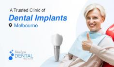 At BlueSpa Dental we specialise in dental implants, offering a reliable and long-lasting solution for missing teeth. Our team of skilled dental professionals is committed to restoring your smile and oral health by providing top-quality dental implant treatments.
