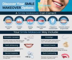 Smile Makeover Options