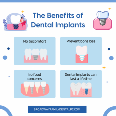 The Benefits of Dental Implants