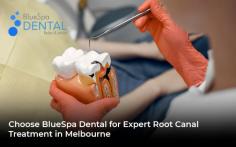 If you are experiencing severe tooth pain or suspect that you may need a root canal treatment, don't hesitate to contact BlueSpa Dental in Melbourne. Our experts will evaluate your condition and recommend the appropriate treatment to relieve your discomfort and restore your dental health. Schedule a consultation today and take the first step towards a pain-free and healthy smile.
https://cosmetic-dentist-melbourne.com.au/root-canal-treatment/