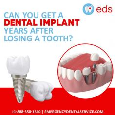 Dental Implant After Tooth Loss | Emergency Dental Service

You can get a dental implant years after losing a tooth. Emergency Dental Service offers same day emergency dental care, including dental implants and root canal treatment. We have dentists available who are on call 24/7 to treat your dental emergency. To schedule your appointment call us at 1-888-350-1340.