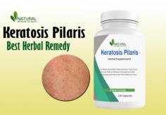 Natural Remedy for Keratosis Pilaris: Cod Liver Oil Treatment
In this article, we'll explore the benefits of cod liver oil as a Natural Treatment For keratosis Pilaris and how it can improve your skin's health.
https://herbscareclinic.blogspot.com/2023/09/natural-remedy-for-keratosis-pilaris.html
