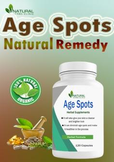 Try these Age Spots Natural Remedies to Recover Naturally
