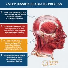 Tension headaches are as common as they are debilitating. It’s difficult to get anything accomplished with constant pain in your head, and the headaches can last for months. Now you can do something about them: search for a headache center near me and then visit Dr. Amr Hosny of the Advanced Headache Center, with eight locations from Midtown Manhattan to Paramus, New Jersey. Dr. Hosny is a Harvard-trained pain management physician specializing in easing headache pain and teaching you how to avoid tension headaches in the future. Call the nearest office today to schedule your consultation.

Are Tension Headaches Common?
Tension headaches are the most common form of headaches. In fact, nearly half of the adult population suffers from some level of tension headache every month. Even more alarming perhaps is that one in 30 adults are diagnosed with chronic headaches that continue for three to six months. In these cases, the sufferers have to bear the pain for at least 15 days during those months.

Headaches can be debilitating, interrupting your day-to-day routines and working life. As a primary headache and cluster headaches and migraines, tension headaches require treatment from a headache specialist like Dr. Amr Hosny. At the Advanced Headache Center, with eight office locations across Midtown Manhattan and Bergen County, New Jersey, you can find a headache doctor near you.

Read more: https://www.advancedheadachecenter.com/headaches/tension-headaches

Advanced Headache Center
41 5th Avenue,
New York, NY 10003
646-763-2222
Web Address https://www.advancedheadachecenter.com/
https://advancedheadachecenter.business.site/
E-mail info@advancedheadachecenter.com

Our location on the map: https://goo.gl/maps/qjau25APCCFC7rpb9

Nearby Locations:
Union Square | Peter Cooper Village | Ukrainian Village | Noho | Greenwich Village
10003 | 10009, 10010 | 10012 | 10014

Working Hours:
Monday: 8am–7pm
Tuesday: 8am–7pm
Wednesday: 8am–7pm
Thursday: 8am–7pm
Friday: 8am–7pm
Saturday: Closed
Sunday: Closed

Payment: cash, check, credit cards.