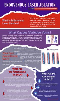 What Is Endovenous Laser Ablation?
This minimally invasive procedure is an effective treatment for varicose veins. It relies on the heat generated by a laser. To get the procedure, visit a Brooklyn and Bronx vein center, such as Astra Vein Treatment Center. After a consultation, an experienced vascular specialist may recommend an endovenous laser treatment (EVLT) called endovenous laser ablation (EVLA).

Varicose veins are twisted, swollen, dark-colored veins that resemble a rope. They often appear on your legs. While they usually aren’t medically dangerous, they are unsightly and can be painful.

To treat them, visit a varicose vein treatment center in Brooklyn and Bronx. Dr. George Bolotin, an Interventional Radiologist who focuses on vascular conditions, offers his expertise at the Astra Vein Treatment Center. He’s familiar with a wide range of vein conditions and their treatments. He can take care of your varicose veins safely and conveniently.

Read more: https://www.astraveinvascular.com/endovenous-laser-ablation-evla-evlt/

Astra Vein Treatment Center
4209A Ave U,
Brooklyn, NY 11234
(718) 222-0225
Web Address https://www.astraveinvascular.com/
https://astraveinvascular.business.site/
E-mail info@astraveinvascular.com 

Our location on the map: https://goo.gl/maps/QEnnotqxPgcHbxu56
https://plus.codes/87G8J35G+RM Brooklyn

Nearby Locations:
Sheepshead Bay | Madison | Marine Park | Old Mill Basin | Mill Basin
11235, 11223, 11224 | 11229 | 11234

Astra Vein Treatment Center
869 E Tremont Ave
Bronx, NY, 10460
(929) 447-4563

Google maps: https://goo.gl/maps/nCPXjbmcEDT9LxhL6
https://plus.codes/87G8R4V7+7H

Nearby Locations:
Crotona | Claremont | Crotona Park East | Charlotte Gardens | Van Nest | Soundview
10459 | 10460 | 10462

Working Hours:
Monday: 9am–6pm
Tuesday: 9am–6pm
Wednesday: 9am–6pm
Thursday: 9am–6pm
Friday: 9am–6pm
Saturday: Closed
Sunday: Closed

Payment: cash, check, credit cards.