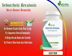 We will explore Home Remedies for Seborrheic Keratosis, offering you effective methods to bid farewell to these unwelcome skin growths.
