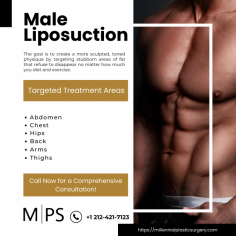 360 liposuction is one of the most comprehensive treatments you can get to give your body the shape you’ve longed to see. Whether you’re a woman looking for that hourglass figure or a man who wants to show off six-pack abs, traditional or awake 360 lipo is the treatment that removes the excess fat in your way. In Manhattan, the best plastic surgeon to do your liposculpture 360 procedure is Dr. David Shokrian at Millennial Plastic Surgery. Get fat removed all the way around your midsection to show off the classic contours underneath. Call today for an appointment for an awake or traditional lipo 360 procedure.

What Is Liposuction 360?
Say goodbye to love handles and muffin tops, and say hello to the hourglass figure you crave. The advanced techniques of 360 lipo provide a dramatic change in a relatively short period of time. Your curvier waistline becomes apparent in as soon as four weeks, and you can celebrate the overall results — a smooth, sculpted hourglass figure or a lean, mean rugged machine — in only three months.

Liposuction 360, also referred to as 360 lipo, takes a highly developed body contouring technique and covers a greater portion of your body than a single treatment with traditional liposuction. Liposuction overall is a common surgical procedure for both men and women that safely removes unwanted fat that just won’t disappear no matter how much you diet and exercise.

The specialized skills needed to perform a traditional or awake 360 lipo take years of training and experience. If you live in the New York City area, the go-to place for this unique cosmetic surgery is Millennial Plastic Surgery. Led by Dr. David Shokrian, this team of professionals perform the latest procedures available for your face, breasts, and body.

Millennial Plastic Surgery
56 W 45th St, 4th Floor
New York, NY 10036
(212) 421-7123
Web Address https://millennialplasticsurgery.com/
https://millennialplasticsurgery.com/manhattan-ny/

Our location on the map: https://www.google.com/maps?cid=9934321547707838865

Nearby Locations:
Midtown West | Garment District | Diamond District | Midtown East | Murray Hill | Hell's Kitchen
10019, 10036, 10018, 10001, 10022, 10016, 10017

Working Hours:
Mon - Fri: 9:00am - 5:00pm
Sunday: 9:00am - 5:00pm - By appointment only.

Payment: cash, check, credit cards.