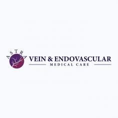 The Astra Vein Treatment Center in Brooklyn is the foremost center for New Yorkers seeking expert diagnoses and treatment for vein abnormalities, from varicose veins to deep vein thrombosis. The vein treatment center was founded by Dr. George Bolotin, an accomplished Interventional Radiologist who brings extensive education, training and experience to his practice. Alongside Astra Fibroid Treatment Specialists, Dr. Bolotin and his team of vascular specialists accept most insurance coverage, making the Brooklyn-based practice ideal for all your vein and fibroid conditions. Call the center today for a consultation by number 718-222-0225.

Astra Vein Treatment Center
4209A Ave U,
Brooklyn, NY 11234
(718) 222-0225
Web Address https://www.astraveinvascular.com/
https://astraveinvascular.business.site/
E-mail info@astraveinvascular.com 

Our location on the map: https://goo.gl/maps/QEnnotqxPgcHbxu56

Nearby Locations:
Sheepshead Bay | Madison | Marine Park | Old Mill Basin | Mill Basin
11235, 11223, 11224 | 11229 | 11234

Working Hours:
Monday: 9am–6pm
Tuesday: 9am–6pm
Wednesday: 9am–6pm
Thursday: 9am–6pm
Friday: 9am–6pm
Saturday: Closed
Sunday: Closed

Payment: cash, check, credit cards.