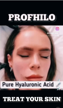 This revolutionary new treatment takes just ten minutes, with five injection points into the mid and lower face. It stimulates four different types of collagen and elastin due to the slow release of hyaluronic acid, and it is this stimulation that results in significant improvement of tissue quality.

Know more: https://www.regentstreetclinic.co.uk/profhilo/