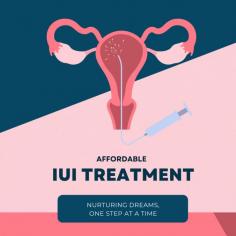 Intrauterine Insemination (IUI): Discover the advantages and methodologies behind the IUI treatment for many who are facing fertility challenges. Understand how intrauterine insemination can help. For more information, visit now!