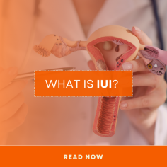 Intrauterine Insemination (IUI): Understand the advantages and methodologies behind the IUI treatment for many who are facing fertility challenges. Know how intrauterine insemination can help.