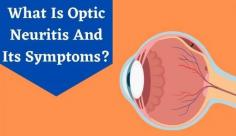 Explore the causes and treatments of optic neuritis symptoms which happen due to inflammation & swelling of Optic Nerve. Learn more about neuritis symptoms, causes & treatments on Livlong!