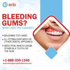 Bleeding Gums? | Emergency Dental Service

Bleeding Gums? Causes may include brushing too hard, ill-fitting dentures, or infections in teeth or gums. Don't ignore it; seek professional advice and rely on Emergency Dental Service for immediate care. Schedule an appointment at 1-888-350-1340.

