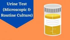 Discover everything about urine testing or urine analysis which is done to assess the visual, chemical, and microscopic aspects of your urine. Know more about the urinalysis test at Livlong.