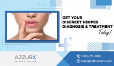 Get Trusted Herpes Treatment Here!

Uncover the most effective and highly rated herpes treatment options available. AZZURX offer compassionate and confidential care to help you manage outbreaks and reduce symptoms. With proven treatments and personalized support, regain control of your health and live confidently. Take the first step towards a healthier, happier future.
