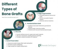 What Is a Dental Bone Graft?
Bone grafting is a surgical procedure that adds density and volume to the jawbone in areas where the bone may be naturally thinner or where bone loss has occurred. Bone grafts are often used to prepare the jaw for dental implants.

There are three main types of bone grafts:

Autogenous bone graft: The bone grafting material can be taken from another site in your body, known as an autogenous graft. The advantage of having this type of graft is that your body will readily accept it, and it should integrate well with your jawbone, but it does mean an additional procedure to harvest the bone from a suitable site.
Allograft or Xenograft bone graft: Alternatively, bone can be sourced from a donor, human (allograft) or animal (xenograft). It is quite usual to use donor bone, and there is no need to worry as the bone is treated and sterilized extensively to ensure it is completely safe for use.
Alloplast: Another alternative is to have a synthetic bone graft material, and this type of graft is called an alloplast. Synthetic bone grafting materials are extremely sophisticated and can often contain growth mediums to encourage your bone to deposit new bone cells onto the graft.
Platelet-rich plasma (PRP) treatment is a treatment that uses platelets from your own blood to promote healing. PRP can be used in conjunction with bone grafting to help the bone graft heal faster and promote better tissue regeneration.

How bone grafting works
During a bone grafting procedure, your surgeon will make an incision in the gum tissue and expose the jawbone. The surgeon will then place the bone graft material in the area where bone needs to be added. The bone graft will provide a scaffold for your own bone cells to grow onto.

Once the bone graft is in place, the surgeon will close the incision with sutures. The bone graft will need to heal for several months before dental implants can be placed.

Read more: https://www.riversideoralsurgery.com/dental-implants/bone-grafting-for-implants/

Riverside Oral Surgery
130 Kinderkamack Rd #204
River Edge, NJ 07661
(201) 487-6565

Web Address https://www.riversideoralsurgery.com/
E-mail info@riversideoralsurgery.com

Our location on the map: https://maps.app.goo.gl/CCacJsVtmbB5YKvK7
https://plus.codes/87G7WX67+PC

Nearby Locations:
Teaneck, Paramus, Hackensack, Fair Lawn, Bergenfield, New Milford, Oradell, Englewood, Tenafly
07605, 07666, 07653, 07601, 07602, 07603, 07606, 07644, 07410, 07621, 07628, 07670, 07646, 07630, 07649, 07631

Working Hours:
Monday-Friday: 9am - 5pm

Payment: cash, check, credit cards.
