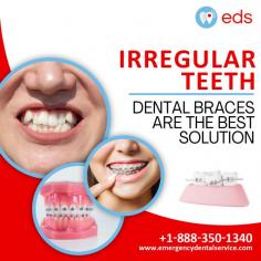 Irregular Teeth | Emergency Dental Service 

Irregular teeth can impact your smile and oral health. Dental braces are a highly effective method of fixing misaligned teeth and improving beauty or general dental health. Achieve a confident, healthy smile with Emergency Dental Service.  Schedule an appointment at 1-888-350-1340.