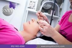 BOTOX Cosmetic is a non-surgical treatment for moderate aesthetic concerns. It works by reducing muscle contractions that cause persistent frown lines over time. The procedure requires no recovery time. If you are interested in this treatment, our Envy Skin Clinic can help you. Please call us at 1-952-983-4588 to learn more about Botox Clinic Bloomington and get answers to your queries.

Website: https://envyskinclinic.com/injections/