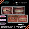 The affordable cost of dental treatments at LUMOS Dental Care & Implant Center Hyderabad, India is the primary reason for patients to visit here, And patients can save up to 70% on their dental bills at lumos dental care. The high quality of treatment and the affordable prices is the reason which is why dental implants at Lumos Dental Care are so popular in India & Abroad..