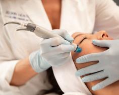 We now offer the microneedling pen treatment at MedSpa California. A vampire facial can help smooth out wrinkles and we provide a pre facial in San Ramon.
