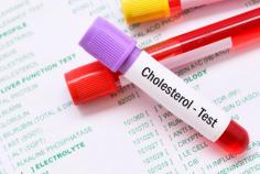 Schedule your cholesterol test in Dartford, Gravesend, or Longfield with Intrigue Health for a healthier heart and lifestyle. Book an appointment today.