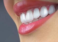 Best Teeth Whitening Treatment in Hadapsar Pune | Platinum Smile Dental Clinic
: You can achieve a perfect and glowing smile by choosing to have teeth whitening at Platinum Smile dental clinic with our skilled dentist in Hadapsar Pune.
