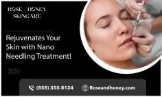 Get Advanced Nano Needling Treatment with Our Experts!

If you have specific skin concerns like fine lines, wrinkles, acne scars, hyperpigmentation, or anti-aging, nano-needling may be competent to help you. Nano-needling treatment in San Diego can be used on patients seeking skin rejuvenation as well. Feel free, we're here to support and guide you towards the process until the end. Get in touch with Rose + Honey Skincare!
