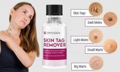 Cryogen Skin Tag Remover is a revolutionary product that offers a fast and easy solution to remove skin tags, warts, moles in the comfort of your home.