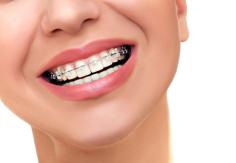 At Seligman Orthodontics in New York, our main purpose is to provide customized, comprehensive and age appropriate orthodontic treatment that you deserve We are located in the heart of New York with three locations in Manhattan, Chelsea and Hamptons.
