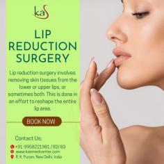 If you have been thinking about getting a lip reduction surgery in Delhi, lip reshaping procedure cost in India contact us for an appointment where we can discuss your requirements in more details