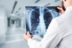 Miamibeachurgentcare.com offers quick and dependable urgent care x-ray treatments. When you need results quickly and accurately, trust us.

https://www.miamibeachurgentcare.com/services