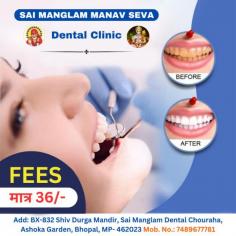 Discover exceptional dental care at Sai Mangalam Manavseva Dental Clinic. From routine check-ups to advanced procedures, our skilled team provides personalized treatment plans for a brighter smile. Experience compassionate care and expertise in a warm, inviting environment. #SaiMangalamDental