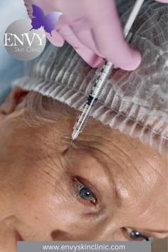 BOTOX Cosmetic is a non-surgical treatment option for modest cosmetic concerns. It works by reducing the muscular spasms that eventually lead to irreversible wrinkles. There's no recovery time following surgery. If you are interested in this therapy, our Envy Skin Clinic can help. Please contact us at 1-952-983-4588 if you have any queries or would like more information about Botox Clinic Bloomington .


Website: https://envyskinclinic.com/injections/
